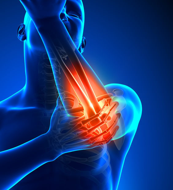 3 Reasons for Elbow Surgery